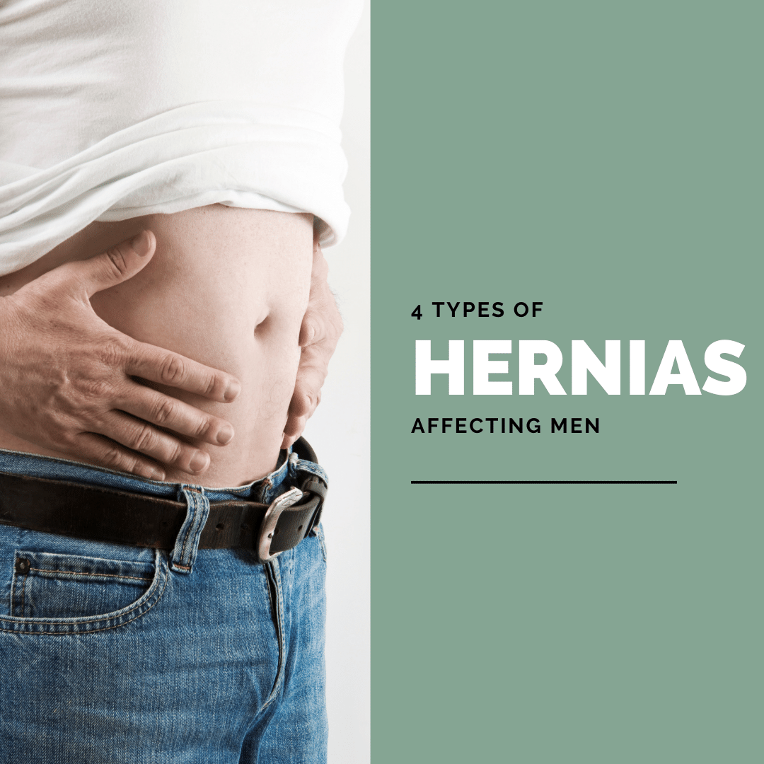 4 Types of Hernias Affecting Men