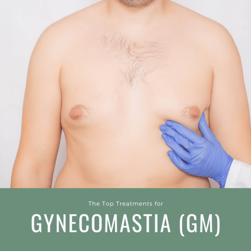 The Top Treatments for Gynecomastia (GM)