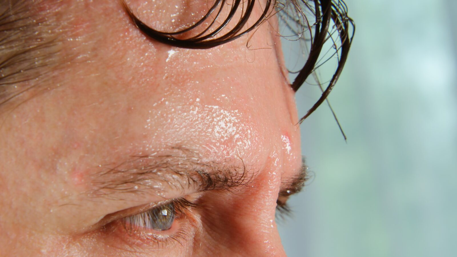 man with very sweaty brow