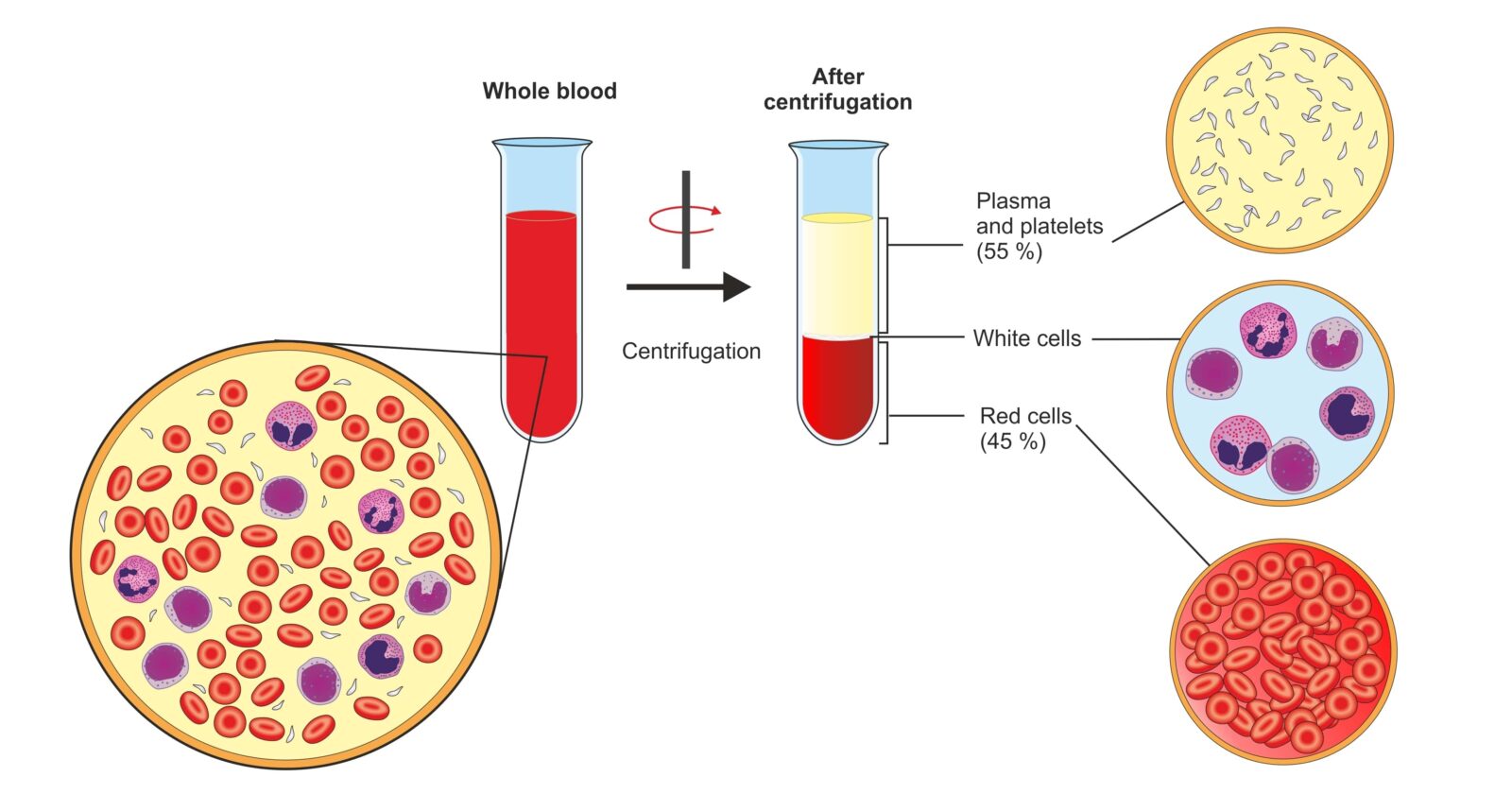 platelet-rich plasma before and after centrifugation